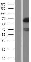 Lipolysis Stimulated Lipoprotein Receptor (LSR) Human Over-expression Lysate