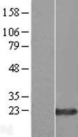 ZNF580 Human Over-expression Lysate