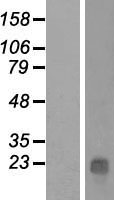 LINC02908 Human Over-expression Lysate