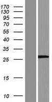 C17orf76 (LRRC75A) Human Over-expression Lysate