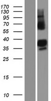 ZC3H14 Human Over-expression Lysate