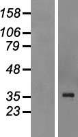 QK1 (QKI) Human Over-expression Lysate
