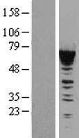 CACNB1 Human Over-expression Lysate