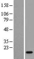 LCN6 Human Over-expression Lysate