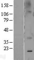 Caveolin 2 (CAV2) Human Over-expression Lysate