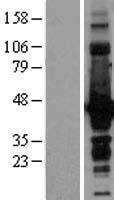 Doublecortin (DCX) Human Over-expression Lysate
