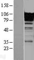 FCN3 Human Over-expression Lysate