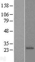 CDw75 (ST6GAL1) Human Over-expression Lysate