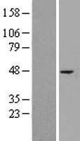 CDw75 (ST6GAL1) Human Over-expression Lysate