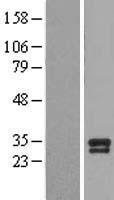 BDNF Human Over-expression Lysate