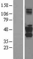 SNX16 Human Over-expression Lysate