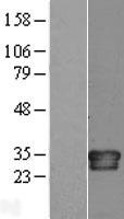 Interleukin 34 (IL34) Human Over-expression Lysate