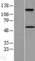 Activin A Receptor Type IC (ACVR1C) Human Over-expression Lysate
