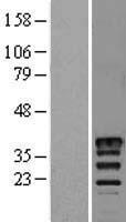 MSI2 Human Over-expression Lysate