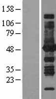 ASS1 Human Over-expression Lysate