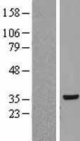 RPLP0 Human Over-expression Lysate