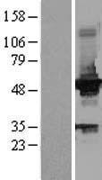 Glucokinase (GCK) Human Over-expression Lysate