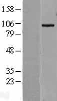 ADAM19 Human Over-expression Lysate