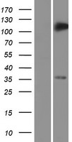 TRIM5 alpha (TRIM5) Human Over-expression Lysate
