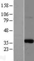 Morg1 (WDR83) Human Over-expression Lysate