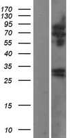 RTBDN Human Over-expression Lysate