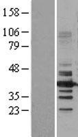 HDAC11 Human Over-expression Lysate