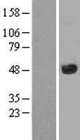 JMJD5 (KDM8) Human Over-expression Lysate