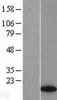 PRR15L Human Over-expression Lysate