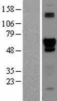 PTOP (ACD) Human Over-expression Lysate