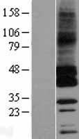 GPRC5C Human Over-expression Lysate