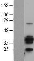 CD20 (MS4A1) Human Over-expression Lysate