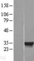 Ocular development associated gene (GATAD1) Human Over-expression Lysate