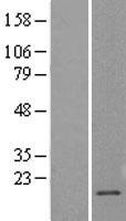 Claudin 1 (CLDN1) Human Over-expression Lysate