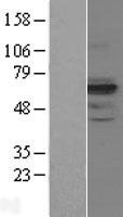 AMHR2 Human Over-expression Lysate