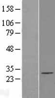 EXOSC5 Human Over-expression Lysate