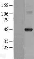 HOXA10 Human Over-expression Lysate