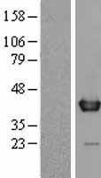 WDR5 Human Over-expression Lysate