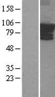 ARHGEF4 Human Over-expression Lysate