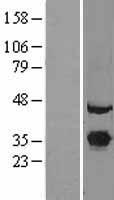 EXOSC7 Human Over-expression Lysate