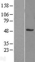 SNX5 Human Over-expression Lysate