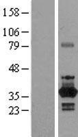 NEK6 Human Over-expression Lysate