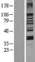 MAN1 (LEMD3) Human Over-expression Lysate