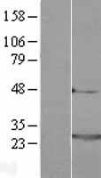 Frequenin (NCS1) Human Over-expression Lysate