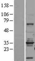 STEAP1 Human Over-expression Lysate