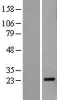 Pallidin (BLOC1S6) Human Over-expression Lysate