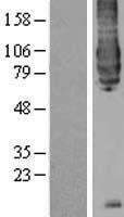 BACE1 Human Over-expression Lysate