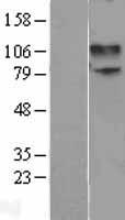 NMDAR1 (GRIN1) Human Over-expression Lysate