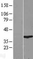 RNF2 Human Over-expression Lysate