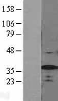 SF2 (SRSF1) Human Over-expression Lysate