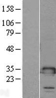 TMED1 Human Over-expression Lysate